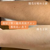 アミューレ(Amewre)
