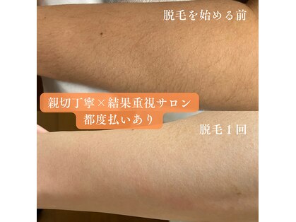 アミューレ(Amewre)の写真