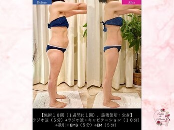 サロンドモアロ(Salon de Moaro)/Before/After