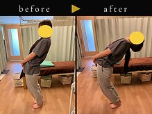 杉本接骨鍼灸院/背骨から全身がユルユル整体