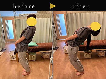 杉本接骨鍼灸院/背骨から全身がユルユル整体