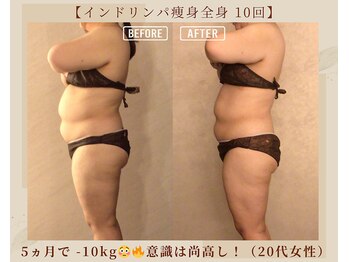 オキシー グレイス 黒崎店(OXY Grace)/インドリンパ痩身全身コース！