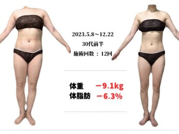 ラヴィ アール(Lavie.R)/痩身/リンパ/リンパマッサージ