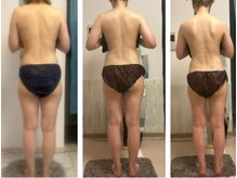 オーシャンブルーム 目黒(OceanBloom)/リンパマッサージハイパーナイフ