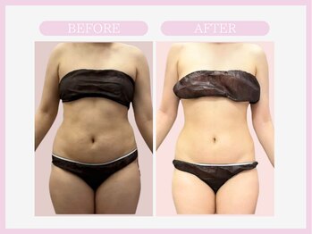 スリムライン 八戸店(The Slim Line)/before→after