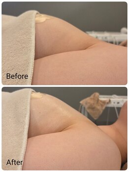 ルナリア ルクス 志木南口駅前店/バストケア&バストアップ