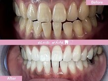 エクシアホワイトニング 西条店/