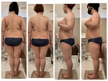 ナチュラルビューティーラボ(Natural Beauty Labo+)/体重は-10kg減！月2～3回/6ヶ月