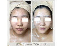 キュキュナチュレの雰囲気（各垢にてビフォーアフターやキャンペーン、最新情報配信中です♪）