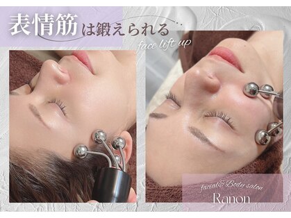 ラノン(Ranon)の写真