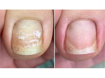 アートラウンジリハナ(Art Lounge Rihana)/フットケア