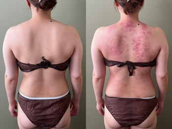 マイティー整骨院 ココア(CoCoa)/セルクラ