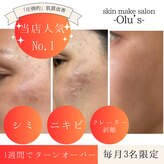 オルズ(Olu's)