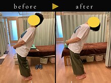 杉本接骨鍼灸院/背骨から全身がユルユル整体