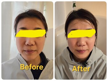 ヨサパーク クレールロゼ(YOSA PARK)