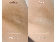 エリィ ワックス(erii wax)/《ルメラ》ワキの黒ずみにも◎