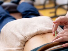 クローバー鍼灸院/鍼灸