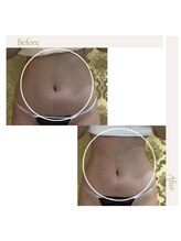 ファロンビューティー(fallon beauty)/お客様ビフォー×アフター