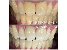 ホワイトニングルーム 横浜店(Whitening Room)/セルフホワイトニング/横浜