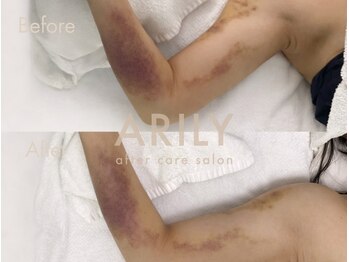 アリリィ(ARILY)/ARILY after care salon