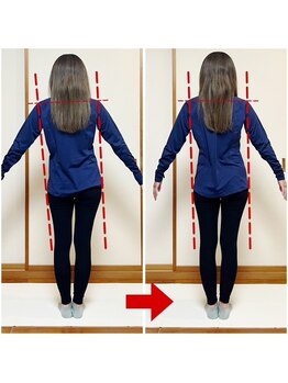 オステオデイジー(OsteoDaisy)/初回で変わる姿勢