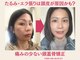 キッカ 岡山店(kikka)の写真