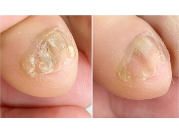 アートラウンジリハナ(Art Lounge Rihana)/フットケア