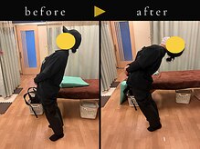 杉本接骨鍼灸院/背骨から全身がユルユル整体