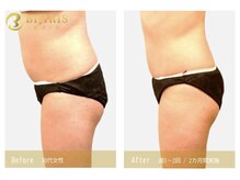 ビジュープラス 幸手店(Bijou+)/ビジリス 30代 週1～2回・2ヶ月