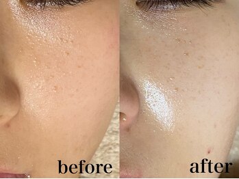 フェイシャルサロン アリイ(ALII)/