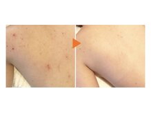 ココルアナ(COCO LUANA)