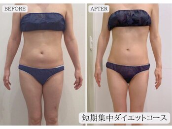 ルミア 函館店(LuMia)/激痩せ短期集中ダイエットコース