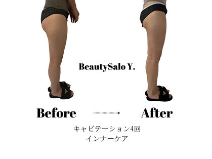 ワイドット(Y.)の写真