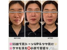 見た目から内側まで、沢山の嬉しい変化を是非楽しんで下さい★