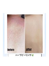 ウィズサロン(withサロン)&nbsp;ハーブ 専門