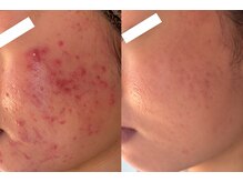 ビジュープラス つくば店(Bijou+)の雰囲気(継続で見違える程の肌質改善が叶う☆見せたくなる肌へスタート!)