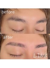 リンク(LINK)/眉毛症例