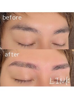 リンク(LINK)/眉毛症例