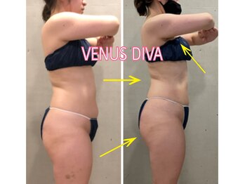 エクセレントビューティーサロン 艶(EN)/減量プログラム　５ｋｇ減量