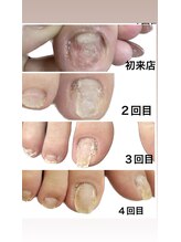 グレースレディ 神戸北店/