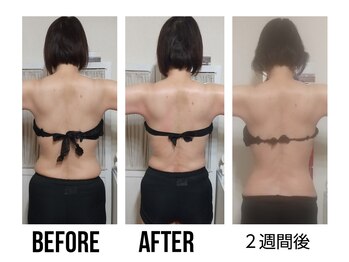 オスマンティエ(Osmantier)/痩身＆リラク☆マシンですっきり