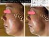 【美肌＆小顔効果◎】人気No1リラクシングフェイシャル60分【疲労感にも◎】