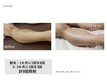 フェレザ 新潟(Felleza)/毛穴の開きも目立たなく◎