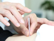 AZ美 整体院/鍼灸が初めて人も◎