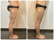 美容整体ウェリナ 名駅院/小顔矯正/骨盤矯正/美脚サロン