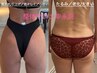 一度でもダイエット効果実感★激痛速攻性リンパ＆小顔100分¥22520→¥16660
