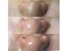 キレイになる路の雰囲気（回数を重ねるごとに鏡を見るのが楽しみに）