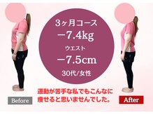 南桜井あおば鍼灸整骨院 春日部/ダイエット実績30代