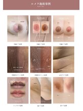 プリマプリート 大垣店/韓国発黒ずみケア☆ルメラ