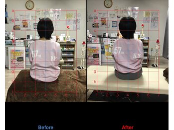 ストレチックス 近江八幡店/姿勢改善ビフォーアフター1回
